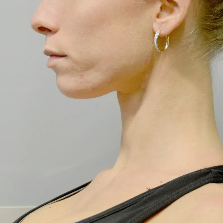 obrazek 4 Kolczyki damskie koła z żółtego złota i brokatu